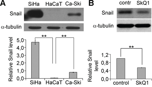 SkQ1 decreased Snail content in SiHa cells.