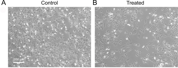 Morphology of Du145 cells treated with or without TGF-&#x03B2;.