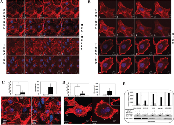Effect of sulindac sulfide on fibronectin-induced cytoskeleton structure of filamentous actin, podia-parameters and activation of RAC1 and Cdc42 in TNBC cells.