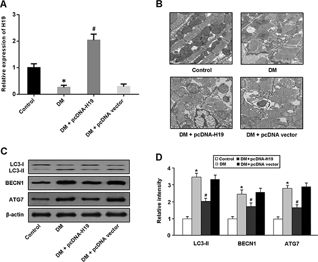 H19 is involved in the suppression of cardiomyocyte autophagy in diabetic rats.