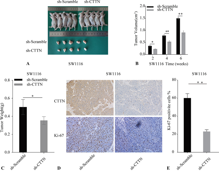 Knockdown of CTTN inhibits CRC cell growth in vivo.