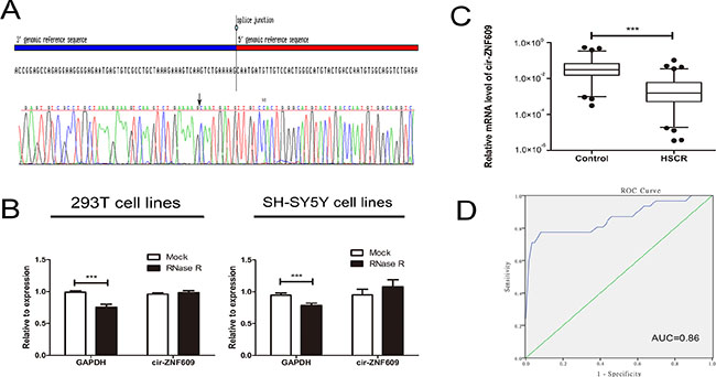 Characteristic and expression of cir-ZNF609 in HSCR.