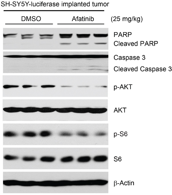 Afatinib induces apoptosis by blocking PI3K/AKT/mTOR signaling in an orthotopic xenograft NB mouse model.