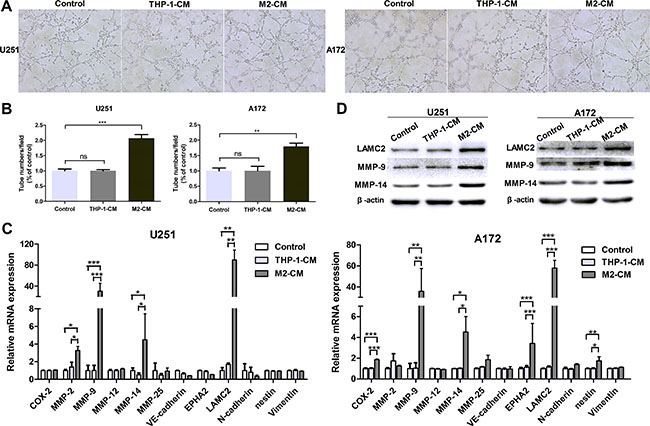 M2-like macrophages drive VM formation of glioma cells in vitro.