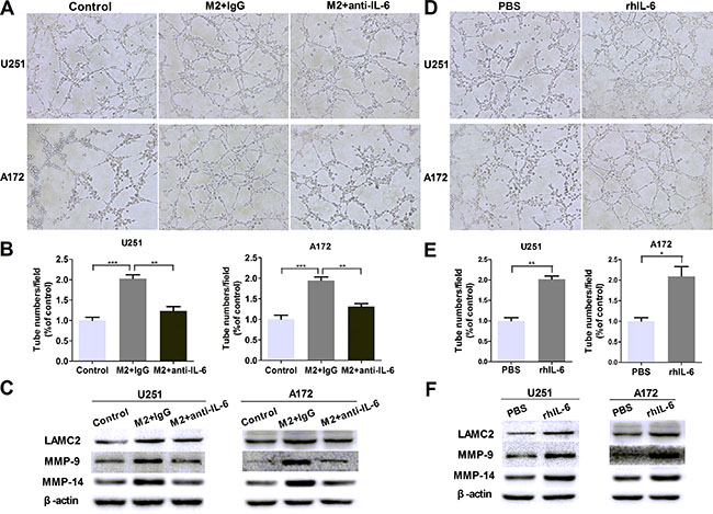 IL-6 upregulation is responsible for VM promotion in glioma cells.