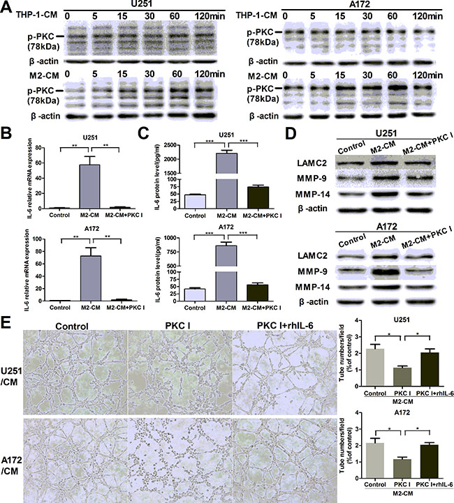 M2-enhanced IL-6 and VM in glioma cells via PKC pathway.