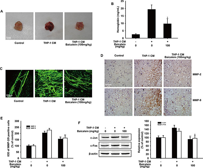 Effect of baicalein on THP-1 CM induced angiogenesis in vivo.