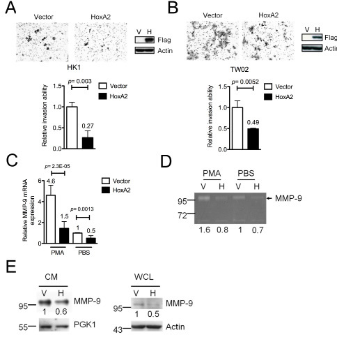 Figure. 3: HOXA2 inhibits cell invasion by down-regulating MMP-9 expression in NPC cells.