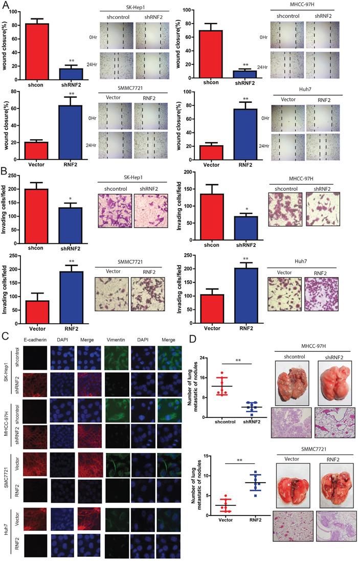 RNF2 knockdown suppresses invasion and metastasis of HCC cells.