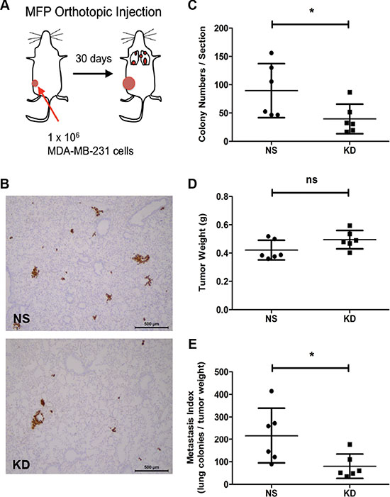 Silencing CYR61 in primary tumors reduces spontaneous lung metastasis formation.