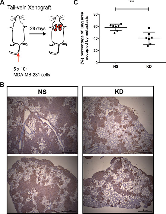 CYR61 down-regulated MDA-MB-231 cells decreases metastatic burden in an experimental model of lung metastasis.