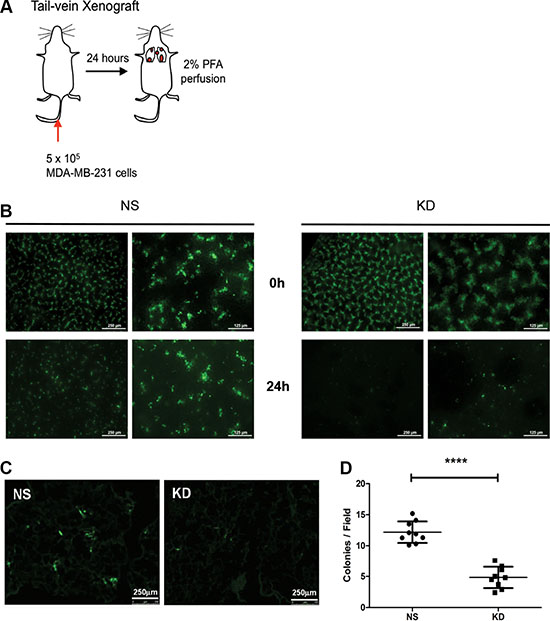 CYR61 facilitates breast cancer cell extravasation into the lung parenchyma.