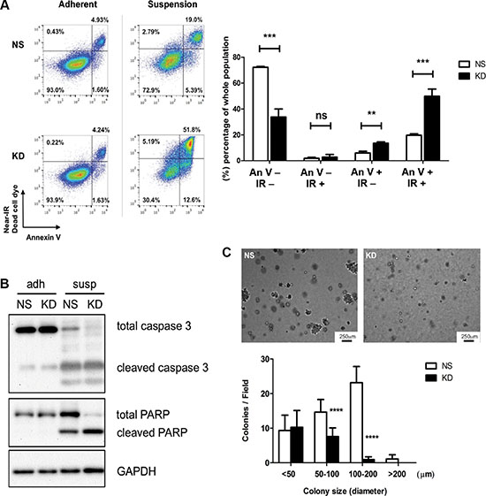 CYR61 protects breast cancer cells from anoikis.