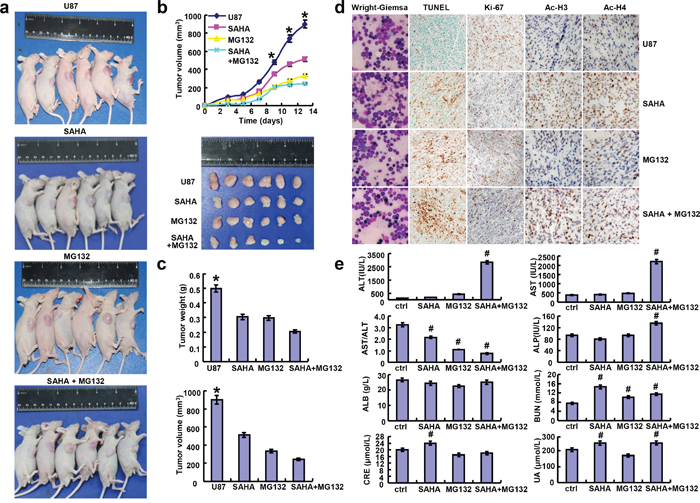 SAHA or/and MG132 suppressed the growth of glioma cells in vivo.