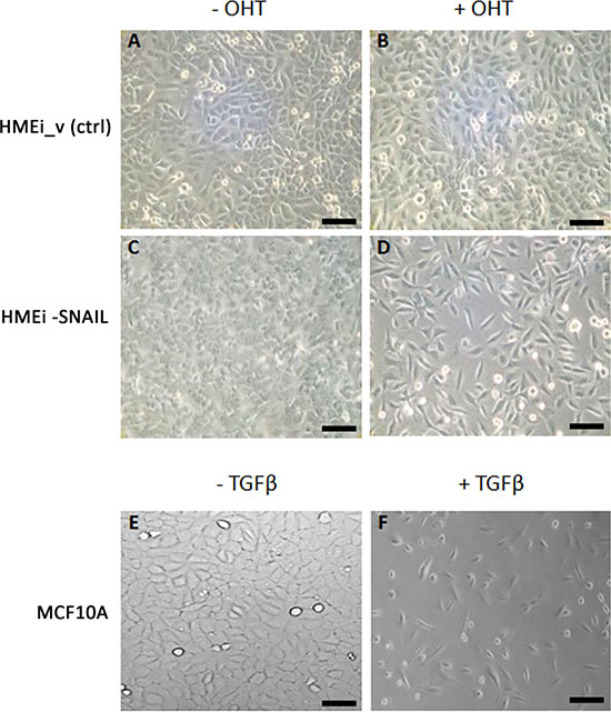 Phase-contrast images of MCF10A, HMEC immortalized with empty vector (HMEi_v) and HMEi-SNAIL cell cultures.
