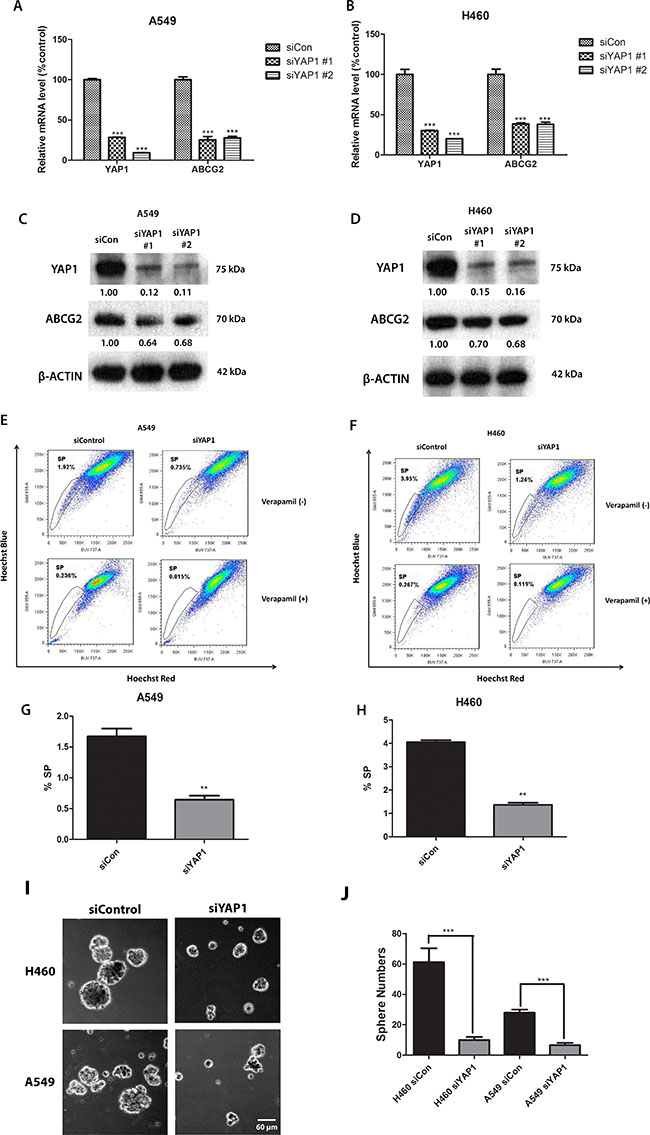 Knockdown of YAP1 decreases ABCG2 expression and the percentage of SP cells in NSCLC cell lines A549 and H460.