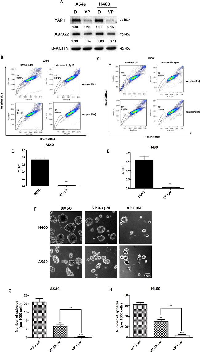 The YAP1-TEAD complex inhibitor verteporfin (VP) reduces ABCG2 expression, the percentage of SP cells and sphere formation in A549 and H460 cell lines and potentiates the cytotoxicity of doxorubicin (DOX).