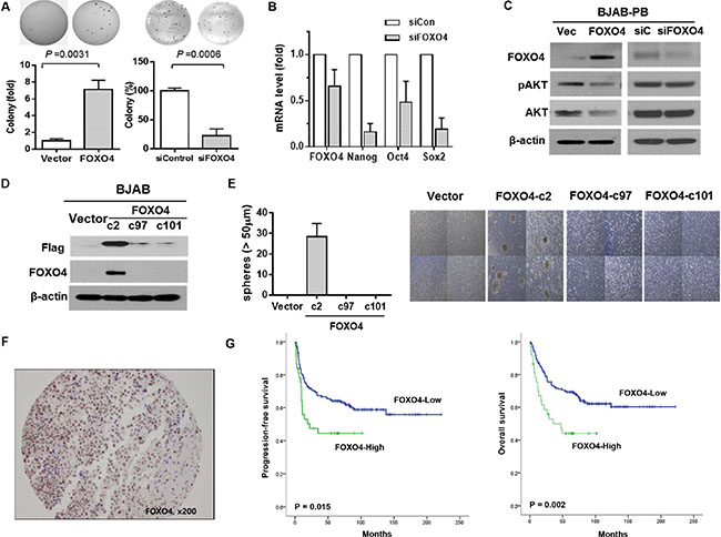 The association of FOXO4 with stem cell properties and prognosis of diffuse large B-cell lymphoma.