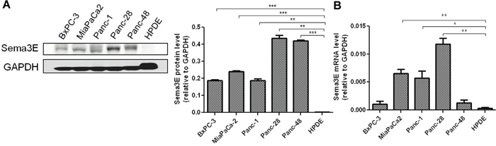 Sema3E is overexpressed in human PDAC lines.