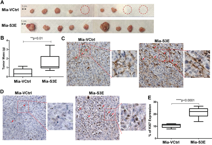 Overexpression of Sema3E increases cancer cell proliferation and tumor growth in vivo.