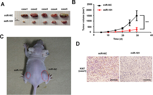 Overexpression of miR-101 suppresses the tumor growth in vivo.