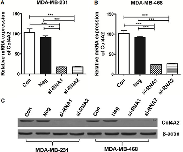 A and B, The relative expression of Col4A2 mRNA and protein in TNBC cells.