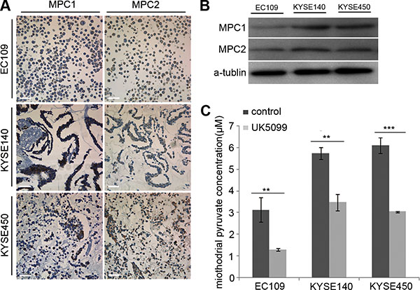 Determination of MPC1 and MPC2 expression and UK5099 blocking effect on pyruvate mitochindrial transportation in squamous esophageal cancer cells.