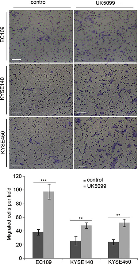 UK5099 application promotes cell migration in the esophageal squamous cancer cells.