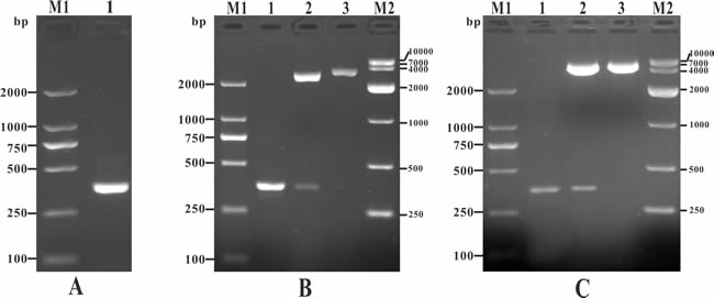 PCR amplification of IL-8 gene, detection of recombinant plasmid T-IL-8 and pcIL-8.