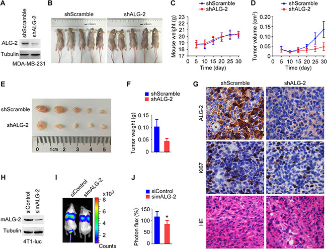 ALG-2 stimulates breast cancer growth and metastasis in mice.