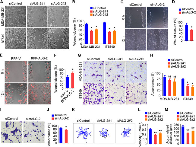 ALG-2 is important for the motility of breast cancer cells.