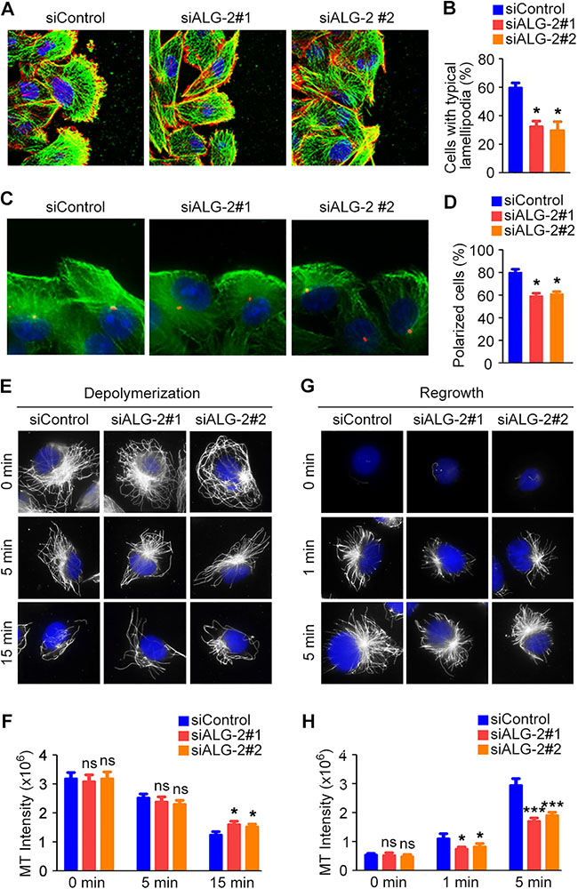 ALG-2 regulates cytoskeletal rearrangement in migrating breast cancer cells.