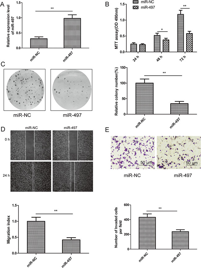 miR-497 inhibits cell proliferation, colony formation, migration and invasion of thyroid cancer cells.