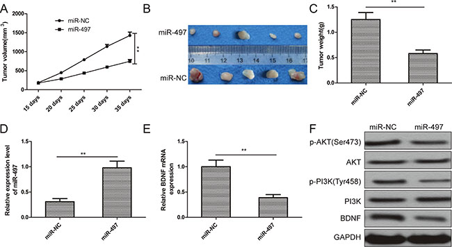 miR-497 suppresses thyroid cancer tumorigenicity in vivo by repressing BDNF.
