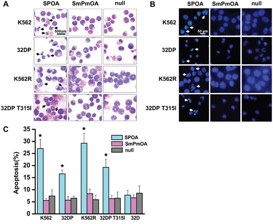 SPOA promotes apoptosis of imatinib sensitive and resistant CML cells.