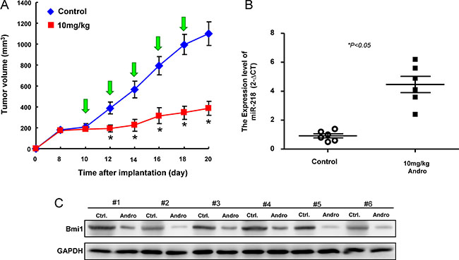 Inhibition of tumor growth by Andrographolide via miR-21/Bmi1 axis