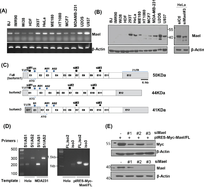 Mael isoform 3 is overexpressed in cancer cells.