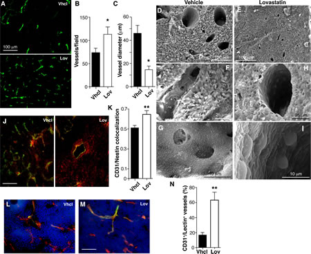 Lovastatin regulates Tg-neu tumor vascular phenotype.