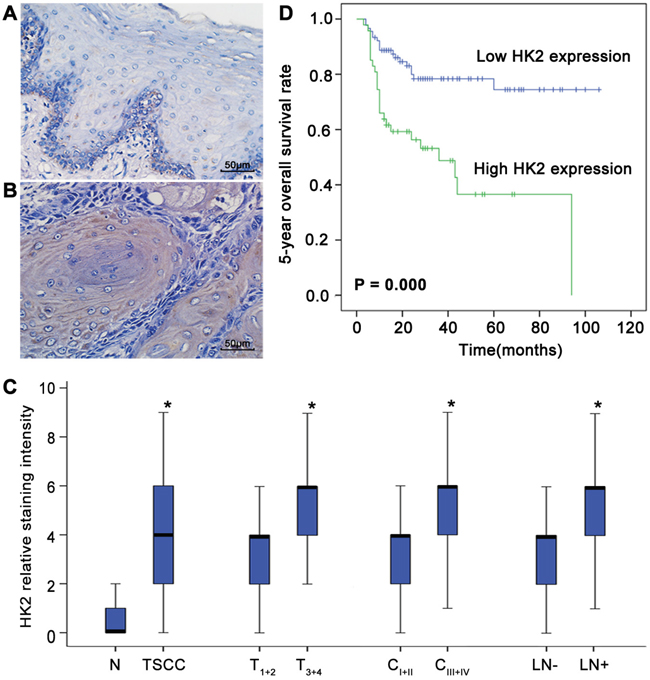 Deregulated HK2 expression is associated with the development of TSCC and prognosis of patients with TSCC.