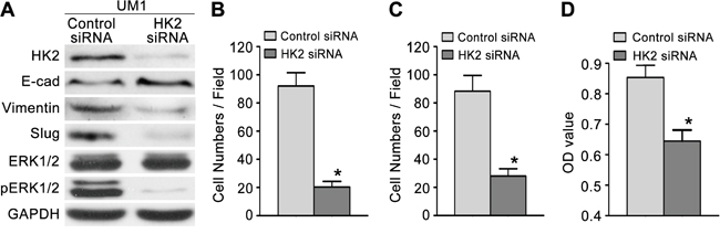 Knocking down HK2 expression inhibits TSCC cell migration and invasion.