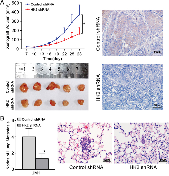 Knocking down HK2 expression inhibits TSCC xenograft growth and lung metastasis in vivo.