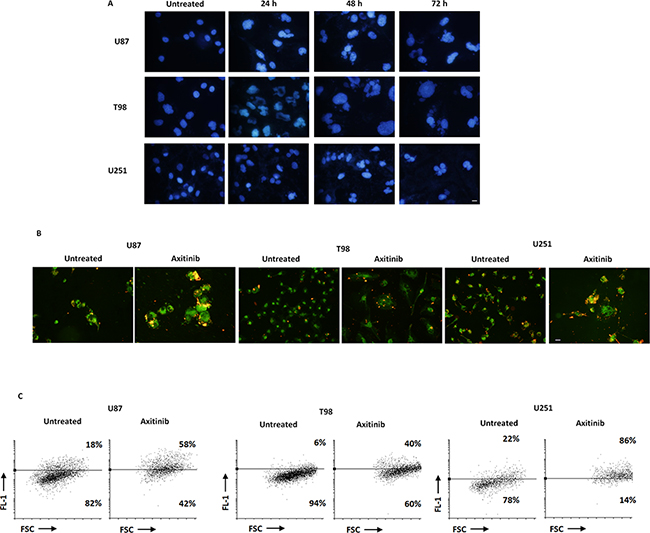 Axitinib triggers mitotic catastrophe in all glioma cell lines.