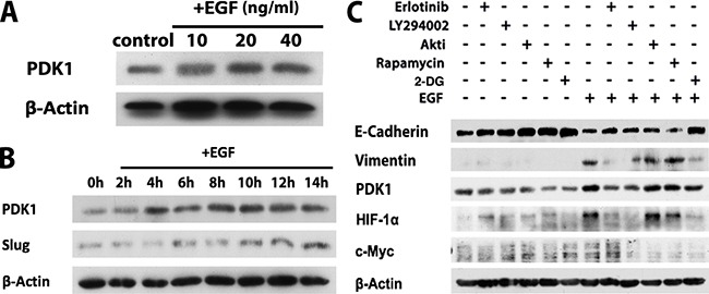 EGFR/PI3K/HIF-1&#x03B1; signaling pathways facilitate glycolysis through promoting PDK1 expression in OSCC cells.