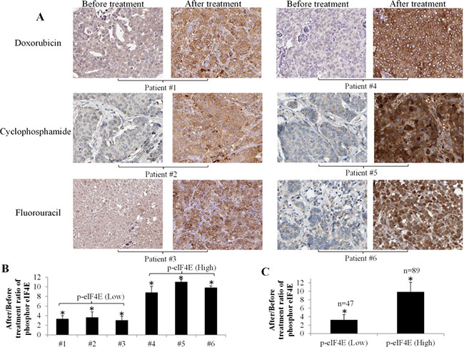 Significant increase of eIF4E phosphorylation in breast cancer patients after chemotherapy.