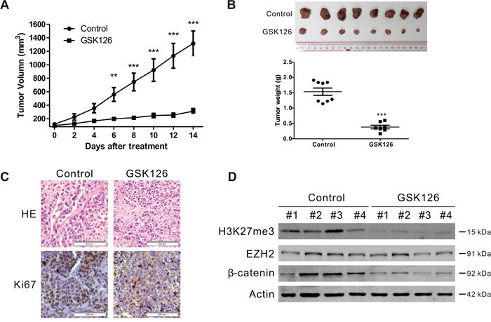 GSK126 abrogates the growth of RPMI8226 cells in subcutaneous xenografts of nude mice.