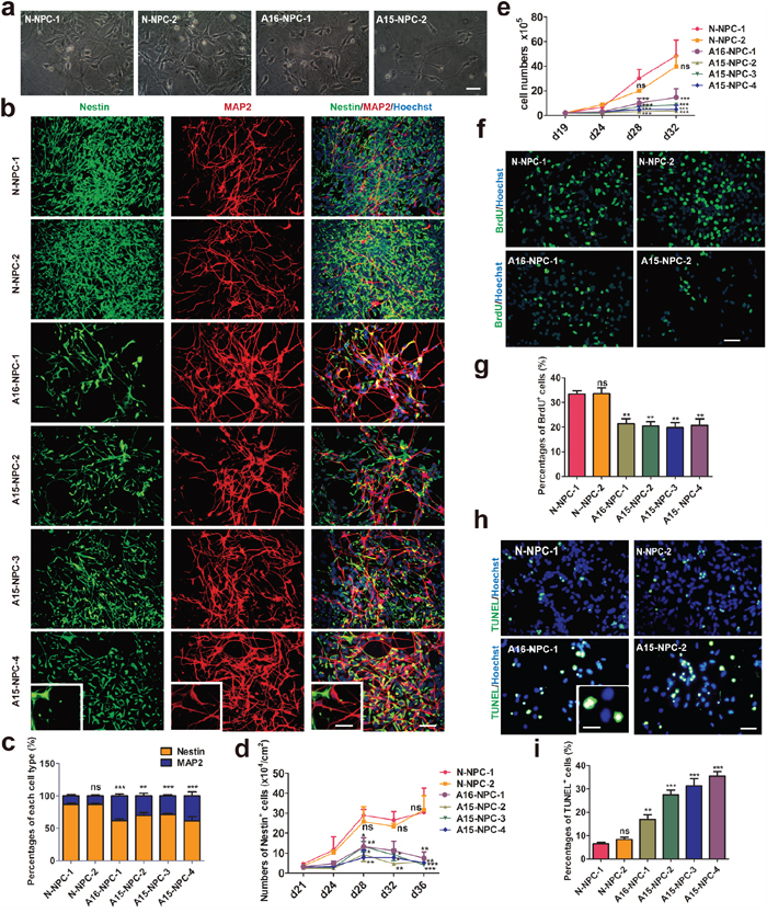 Premature neuronal differentiation occurs in differentiating AD-NPCs.