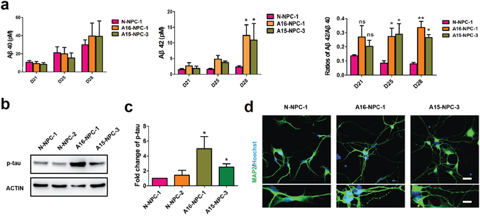 Typical AD pathological changes and degenerating neurons are observed in neuronal differentiation of AD-NPCs.