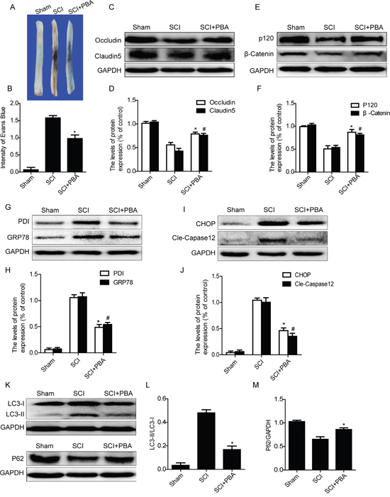 4-PBA treatment ameliorates BSCB disruption and reduces activation of autophagy after SCI.