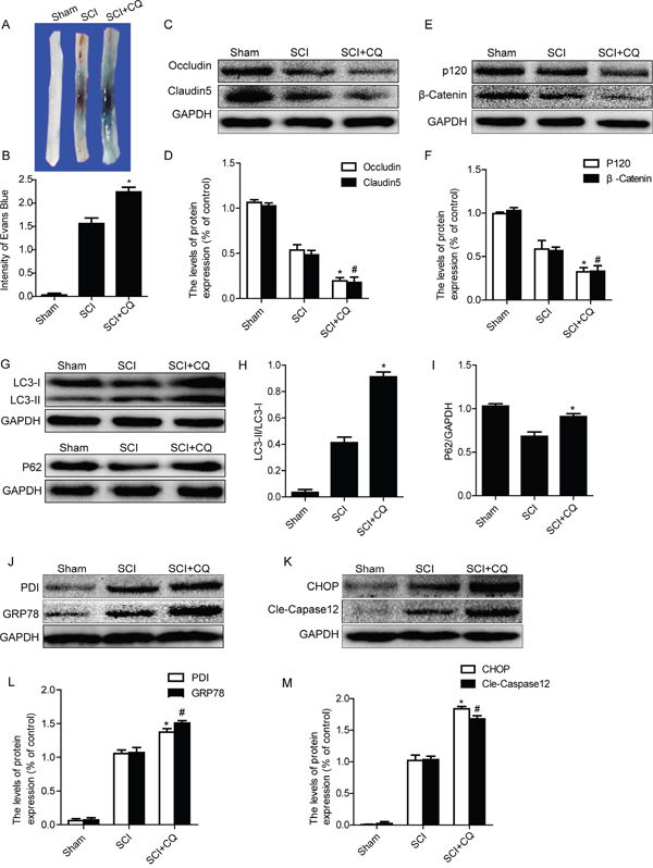 Inhibition of autophagy by chloroquine exacerbates BSCB disruption and ER stress after SCI.