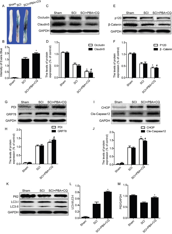 Chloroquine treatment abolishes the BSCB protective effect of PBA by exacerbating ER stress after SCI.